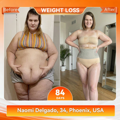 𝐎𝐟𝐟𝐢𝐜𝐢𝐚𝐥 𝐁𝐫𝐚𝐧𝐝 𝐒𝐭𝐨𝐫𝐞 |🎉 𝗞𝙖𝗮𝗟𝒂® 𝟐𝟎𝟐𝟔 𝐌𝐨𝐫𝐢𝐧𝐠𝐚 & 𝐁𝐞𝐫𝐛𝐞𝐫𝐢𝐧𝐞 𝟒-𝐈𝐧-𝟏 𝐌𝐢𝐜𝐫𝐨-𝐏𝐚𝐫𝐭𝐢𝐜𝐥𝐞 𝐒𝐜𝐮𝐥𝐩𝐭𝐢𝐧𝐠 & 𝐅𝐚𝐭-𝐁𝐮𝐫𝐧 𝐒𝐡𝐨𝐫𝐭𝐬💟💟💟💟
