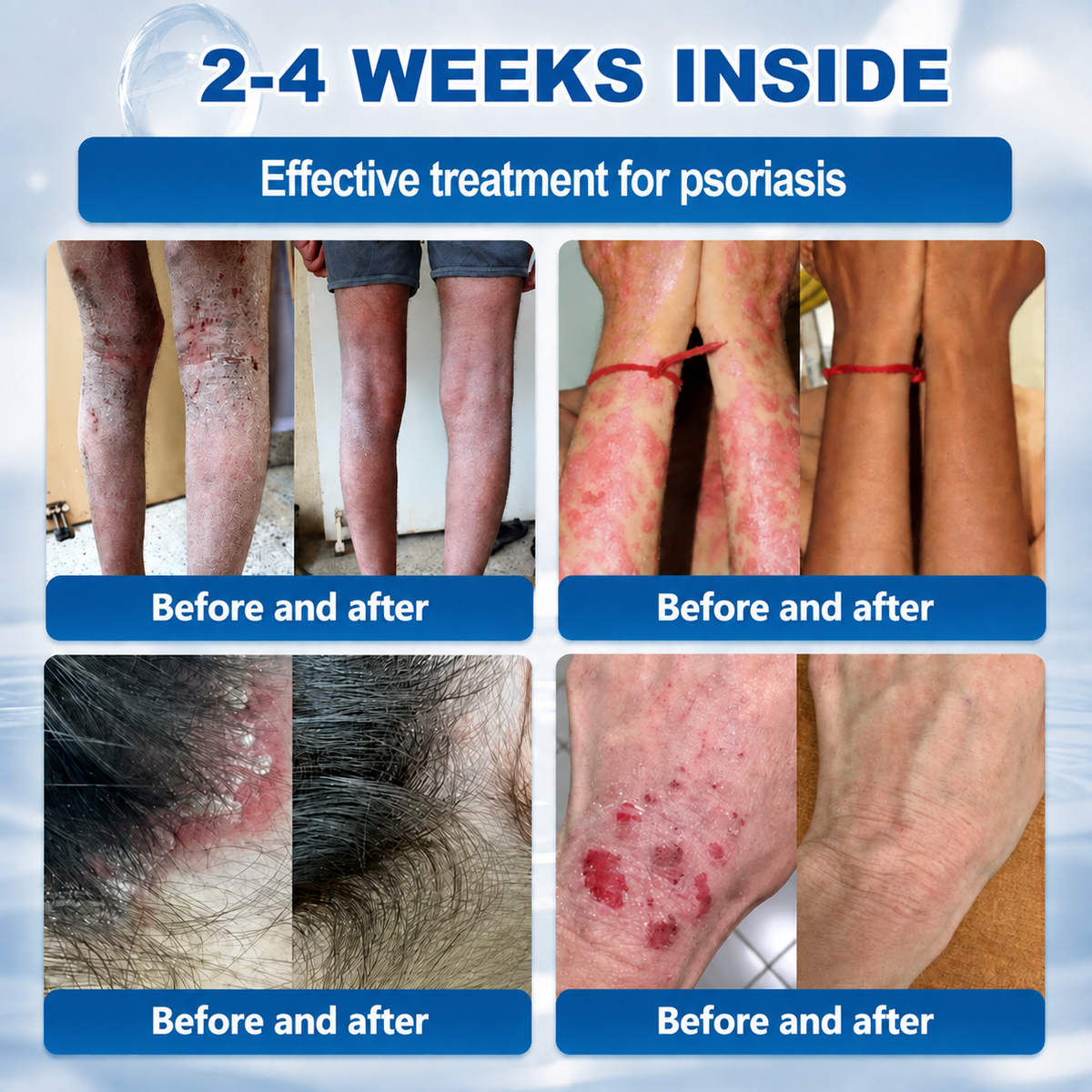 𝐇𝐞𝐚𝐥𝐫𝐢𝐳𝐞® 𝟕-𝐃𝐚𝐲 𝐒𝐤𝐢𝐧 𝐓𝐚𝐠 & 𝐒𝐩𝐨𝐭 𝐄𝐫𝐚𝐬𝐞𝐫 𝐂𝐫𝐞𝐚𝐦 (𝐙𝐞𝐫𝐨 𝐏𝐚𝐢𝐧, 𝐙𝐞𝐫𝐨 𝐒𝐜𝐚𝐫𝐬 𝐅𝐨𝐫𝐦𝐮𝐥𝐚)💎