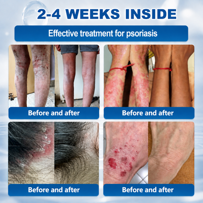 𝐇𝐞𝐚𝐥𝐫𝐢𝐳𝐞® 𝟕-𝐃𝐚𝐲 𝐒𝐤𝐢𝐧 𝐓𝐚𝐠 & 𝐒𝐩𝐨𝐭 𝐄𝐫𝐚𝐬𝐞𝐫 𝐂𝐫𝐞𝐚𝐦 (𝐙𝐞𝐫𝐨 𝐏𝐚𝐢𝐧, 𝐙𝐞𝐫𝐨 𝐒𝐜𝐚𝐫𝐬 𝐅𝐨𝐫𝐦𝐮𝐥𝐚)💎