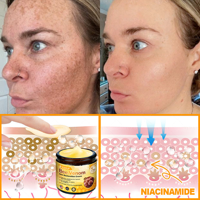 Made and Shipped from USA 🎇 VLSVLS® Bee Venom Skin Restoration Cream 🔥 LAST DAY 80% OFF🔅