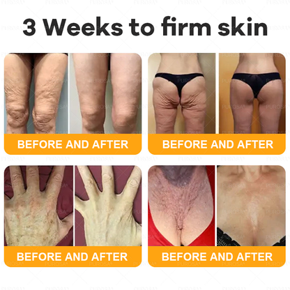 Made and Shipped from USA 🎇 VLSVLS® Bee Venom Skin Restoration Cream 🔥 LAST DAY 80% OFF🔅