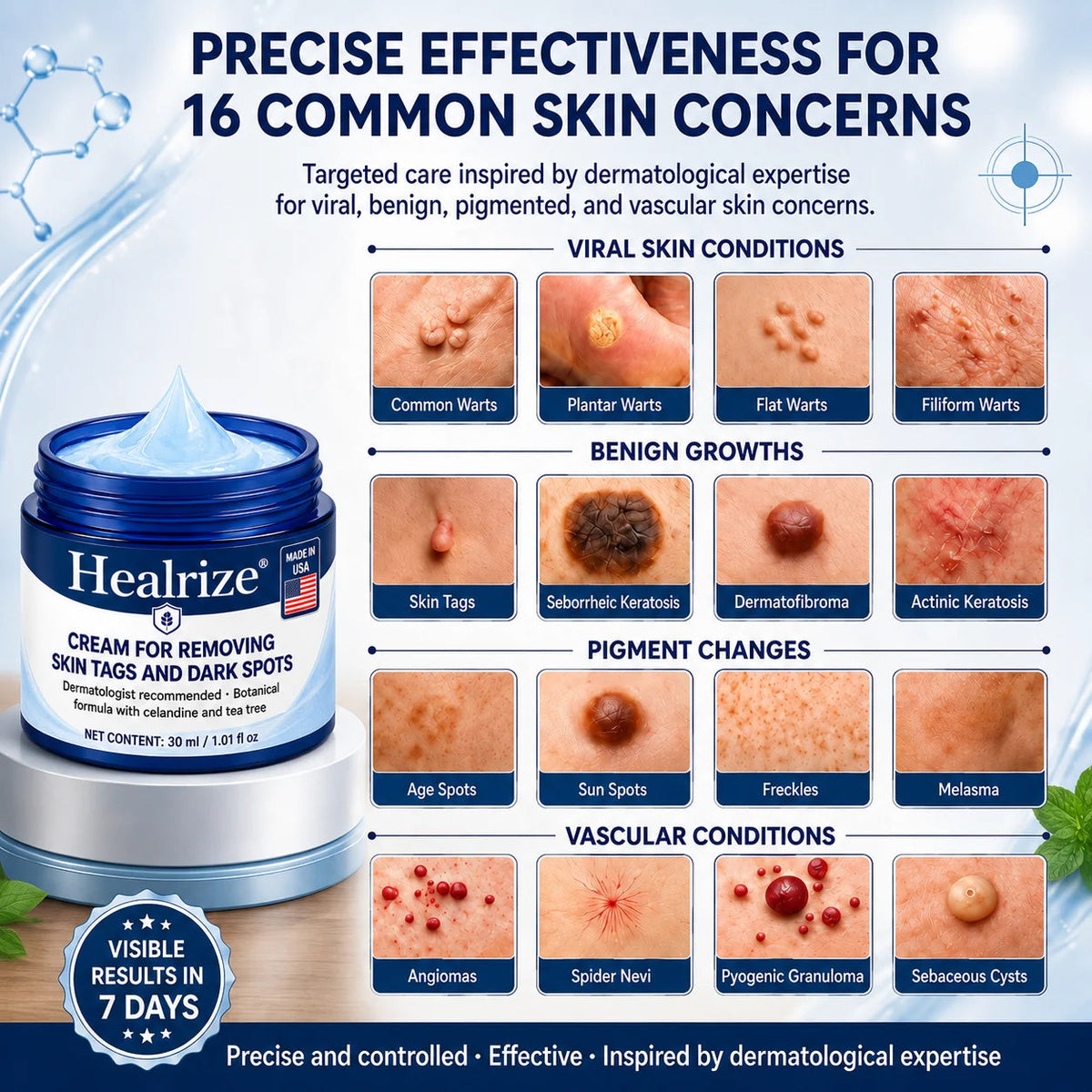 𝐇𝐞𝐚𝐥𝐫𝐢𝐳𝐞® 𝟕-𝐃𝐚𝐲 𝐒𝐤𝐢𝐧 𝐓𝐚𝐠 & 𝐒𝐩𝐨𝐭 𝐄𝐫𝐚𝐬𝐞𝐫 𝐂𝐫𝐞𝐚𝐦 (𝐙𝐞𝐫𝐨 𝐏𝐚𝐢𝐧, 𝐙𝐞𝐫𝐨 𝐒𝐜𝐚𝐫𝐬 𝐅𝐨𝐫𝐦𝐮𝐥𝐚)💎