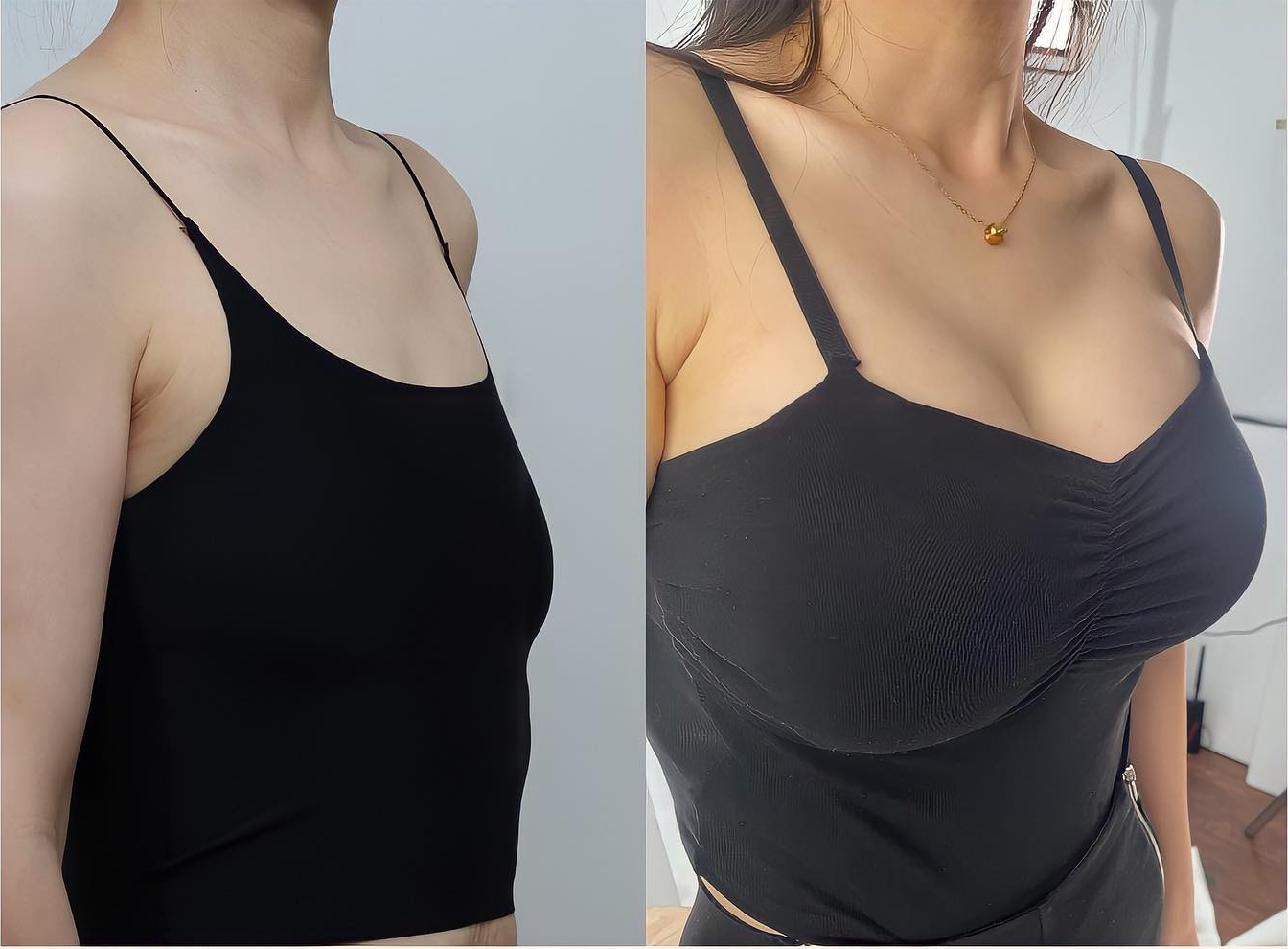 HISKIN® BREAST ENHANCEMENT  LIFT & FIRM MICRONEEDLE PATCHES