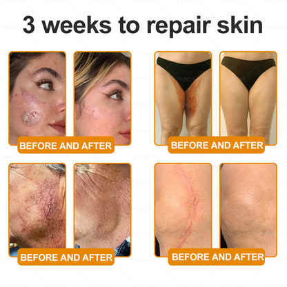 Made and Shipped from USA 🎇 VLSVLS® Bee Venom Skin Restoration Cream 🔥 LAST DAY 80% OFF🔅