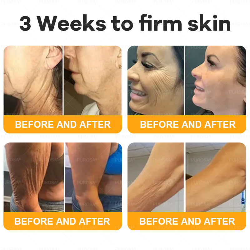 Made and Shipped from USA 🎇 VLSVLS® Bee Venom Skin Restoration Cream 🔥 LAST DAY 80% OFF🔅
